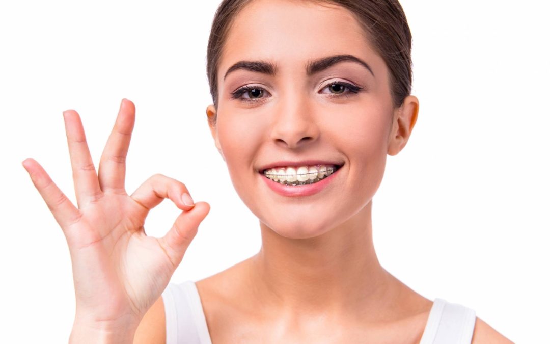 Los 4 beneficios de la ortodoncia para tu sonrisa