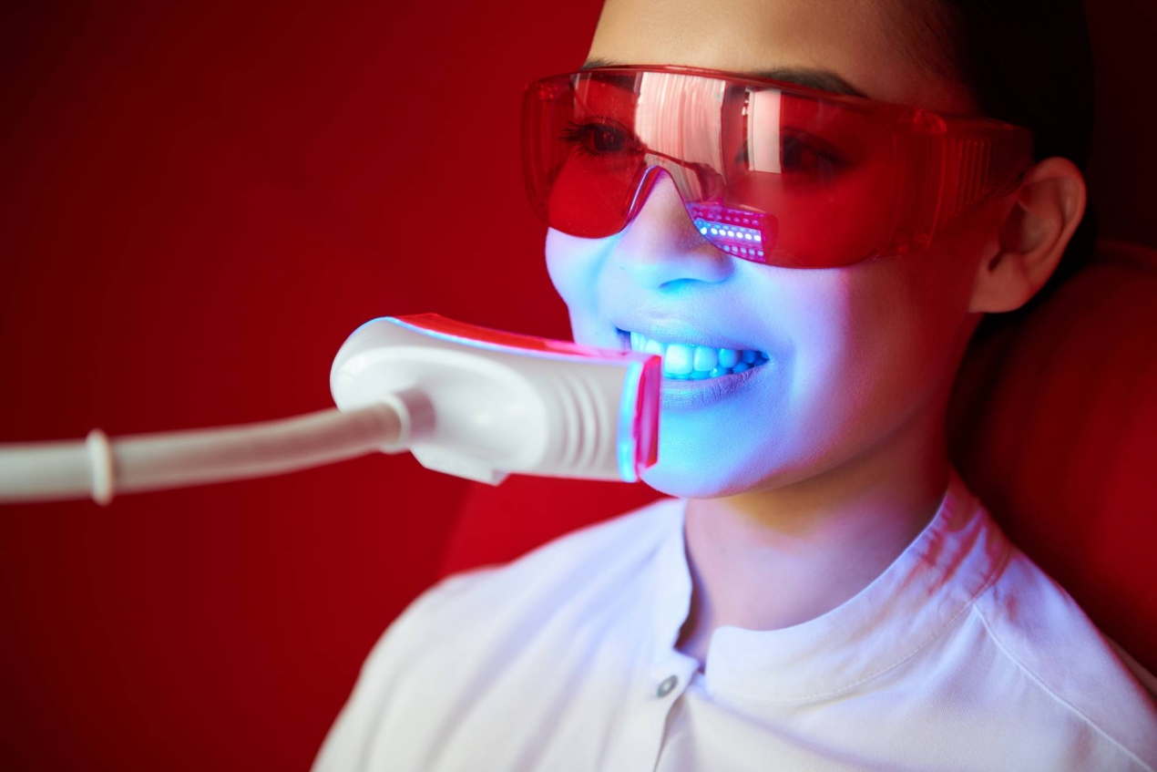 blanqueamiento dental blog